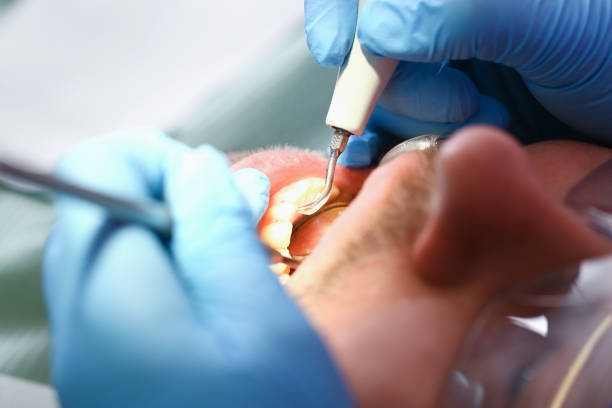 Best Walk-In Emergency Dentist in Coon Rapids, MN
